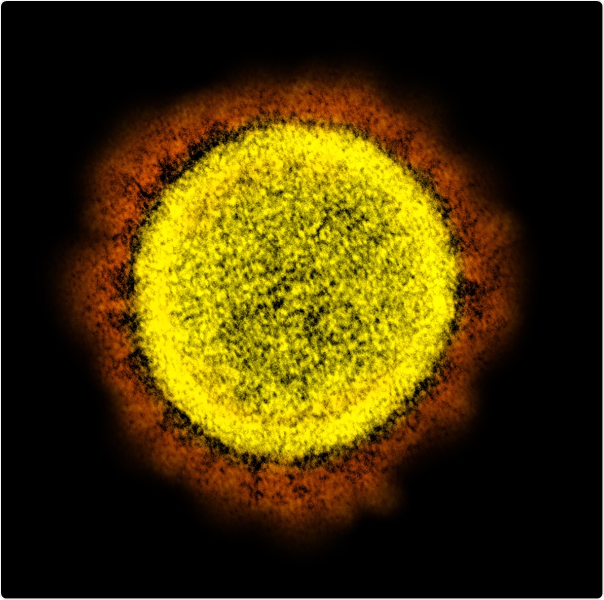 Novel Coronavirus SARS-CoV-2 Transmission electron micrograph of SARS-CoV-2 virus particles, isolated from a patient. Image captured and color-enhanced at the NIAID Integrated Research Facility (IRF) in Fort Detrick, Maryland. Credit: NIAID