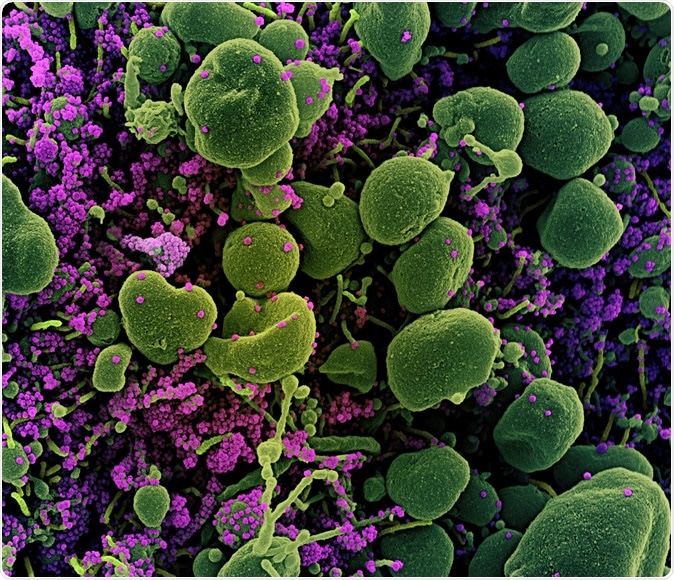 Novel Coronavirus SARS-CoV-2 Colorized scanning electron micrograph of an apoptotic cell (green) heavily infected with SARS-COV-2 virus particles (purple), isolated from a patient sample. Image captured at the NIAID Integrated Research Facility (IRF) in Fort Detrick, Maryland. Credit: NIAID
