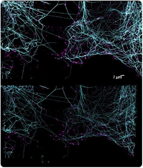 DNA PAINT has enormous potential for multiplexed imaging using the Vutara and its integrated fluidics unit. Using orthogonal docking strands on different probes, a potentially unlimited number of targets are possible. The top image shows a two-color DNA PAINT experiment performed on the Vutara 352 single-molecule localization microscope. Tubulin is labeled in cyan and clathrin in magenta. Due to the unbleachable nature of DNA PAINT, large Z-stacks are possible (bottom). DNA PAINT has enormous potential for multiplexed imaging using the Vutara and its integrated fluidics unit. Using orthogonal docking strands on different probes, a potentially unlimited number of targets are possible. The top image shows a two-color DNA PAINT experiment performed on the Vutara 352 single-molecule localization microscope. Tubulin is labeled in cyan and clathrin in magenta. Due to the unbleachable nature of DNA PAINT, large Z-stacks are possible (bottom).