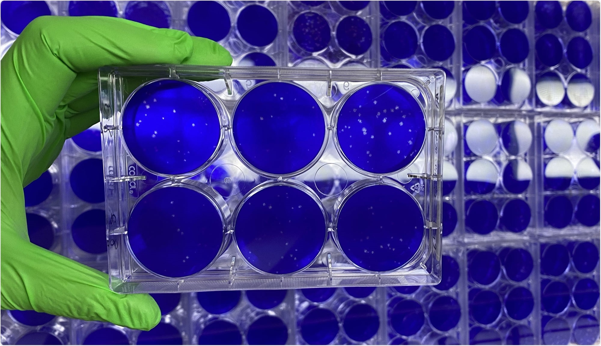 In cell culture studies at BU’s National Emerging Infectious Diseases Laboratories, nanosponges containing fragments of lung cell membranes attracted and fused with the SARS-CoV-2 virus responsible for COVID-19 infections, preventing the coronavirus from infecting living lung cells. Photo courtesy of the Griffiths lab/BU NEIDL
