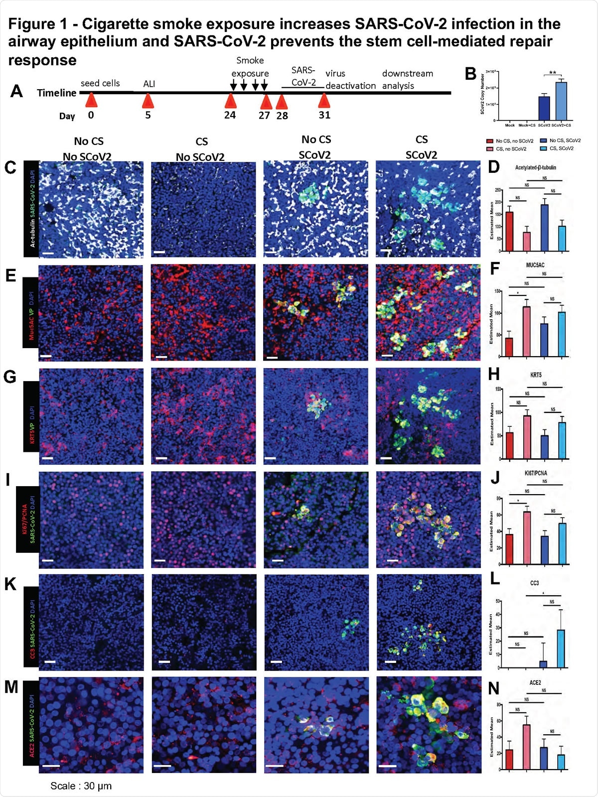 Cigarette smoke exposure increases SARS-CoV-2 infection in the airway epithelium A. Experimental schematic outline showing the total days in culture with days of experimental manipulations B. Quantification of SARS-CoV2 viral load with and without smoking exposure by quantitative real-time PCR of viral mRNA C. IF images of ciliated cells (white) and SARS-CoV-2 (green) infected cells in ALI cultures across the four exposure conditions of no smoking and no virus, smoking and no virus, no smoking and virus and both smoking and virus exposures D. Quantification of number of ciliated cells across the four exposure groups E. IF images of Muc5AC (red) mucus cells and SARS-CoV-2 (green) infected cells in ALI cultures across the four exposure conditions F. Quantification of number of Muc5AC+ mucus cells across the four exposure groups G. IF images of K5 (red) ABSCs and SARS-CoV-2 (green) in ALI cultures across the four exposure conditions H. Quantification of number of ABSCs across the four exposure groups I. IF images of ACE2 (red) and SARS-CoV-2 (green) in ALI cultures across the four exposure conditions J. Quantification of number of ACE2+ cells across the four exposure groups K. IF images of both Ki67 and PCNA (red) and SARS-CoV-2 (green) expressing cells in ALI cultures across the four exposure conditions L. Quantification of number of proliferating cells across the four exposure groups M. IF images of cleaved caspase 3 (CC3)(white) and SARS-CoV-2 (green) for apoptosis across the four exposure conditions N. Quantification of number of apoptotic cells across the four exposure groups Bar graph represents SEM, n = 3-6. *p < 0.05, ** p<0.01, ns = not significant by Turkey test.
