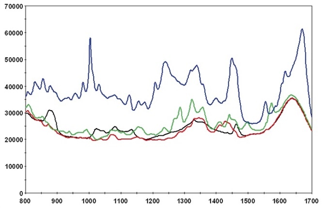 Real-time Analysis of Downstream Biopharmaceutical Operations