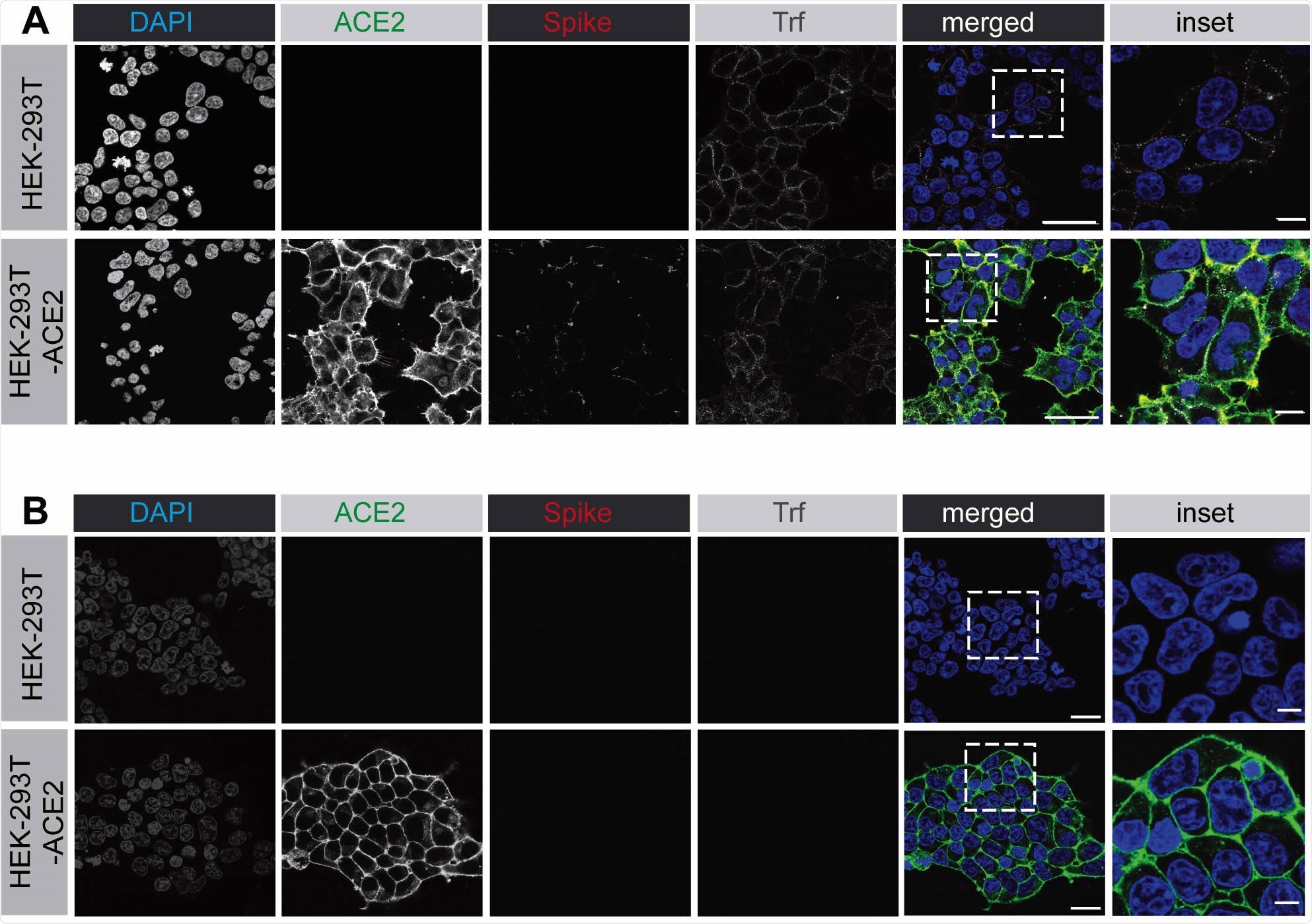SARS-CoV-2 spike protein binds to the surface of HEK-293 cells expressing ACE2. (A) HEK-293 cells, wild-type (top row of images) or stably expressing ACE2 (bottom row of images) were incubated with purified, His6-tagged spike protein and with alexa-647 labelled transferrin for 30 min at 4°C. Following PBS wash, the cells were fixed and stained with DAPI to reveal nuclei, with an antibody selectively recognizing ACE2, and with an antibody recognizing the His6 epitope tag of the spike protein. Scale bars = 40 µm for the low mag images and 10 µm for the higher mag inset of the composite. (B) Experiment performed as in A except that the HEK-293 cells were briefly acid washed prior to fixation. Scale bars = 40 µm for the low mag images and 10 µm for the higher mag inset of the composite.