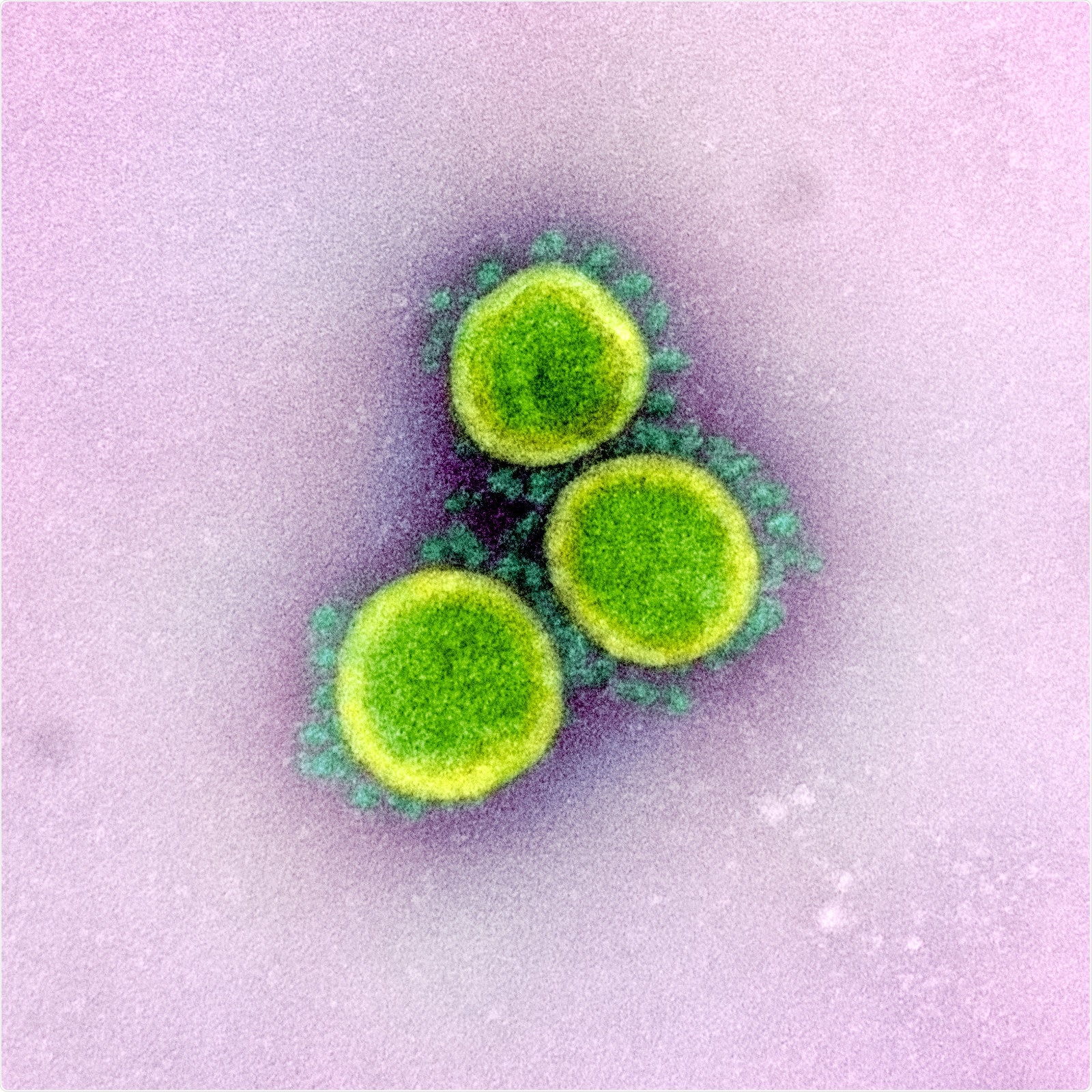 Transmission electron micrograph of SARS-CoV-2 virus particles, isolated from a patient. Image captured and color-enhanced at the NIAID Integrated Research Facility (IRF) in Fort Detrick, Maryland. Credit: NIAID