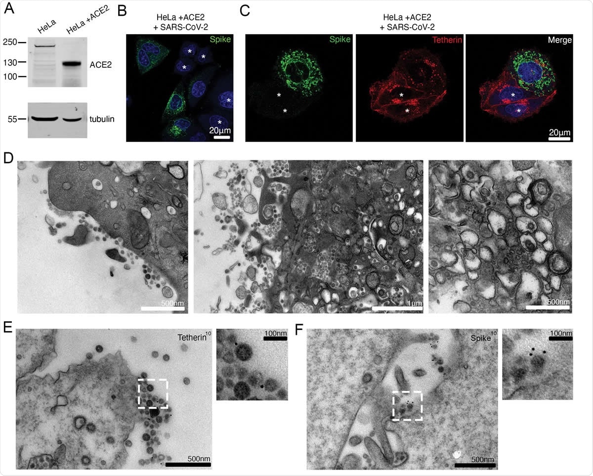 SARS-CoV-2 infection downregulates tetherin in HeLaWT +ACE2 cells. (A) HeLa cells were transduced with ACE2 lentivirus to generate stable cell lines. Mock and ACE2 transduced cells were lysed and immunoblotted for ACE2. Tubulin was used as a loading control. (B) HeLaWT +ACE2 cells were infected with SARS-CoV-2 (MOI 0.5). Cells were fixed at 24 hpi and stained for spike (green) and DAPI (blue). (C) HeLaWT +ACE2 cells were infected with SARS-CoV-2 (MOI 0.5). Cells were fixed at 24 hpi and stained for spike (green), tetherin (red) and DAPI (blue). Uninfected cells shown with asterisk. (D) Electron micrographs showing plasma membrane associated SARS-CoV-2 virions and virus filled intracellular organelles. SARS-CoV-2 infected HeLaWT +ACE2 cells (MOI 0.5) were fixed at 24 hpi and processed for TEM. Left micrograph – plasma membrane-associated virus, middle micrograph – virusfilled tubulovesicular compartments are directed towards the plasma membrane, right micrograph – virions within DMVs. (E) Surface immunogold electron microscopy of SARS-CoV-2 infected HeLaWT +ACE2 cells. Cells were infected with SARS-CoV-2 (MOI 0.5), fixed at 24 hpi and immunogold labelled with antibodies against tetherin. (F) As (E) but labelled with antibodies against SARS-CoV-2 spike.