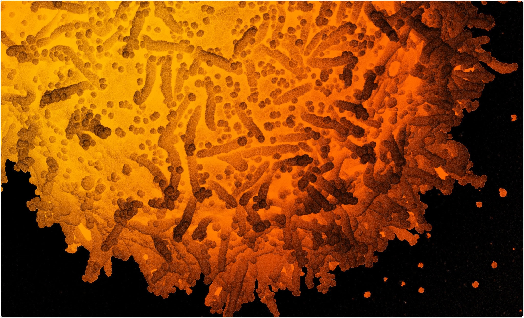 Study: Comprehensive mapping of mutations to the SARS-CoV-2 receptor-binding domain that affect recognition by polyclonal human serum antibodies. Image Credit: NIAID