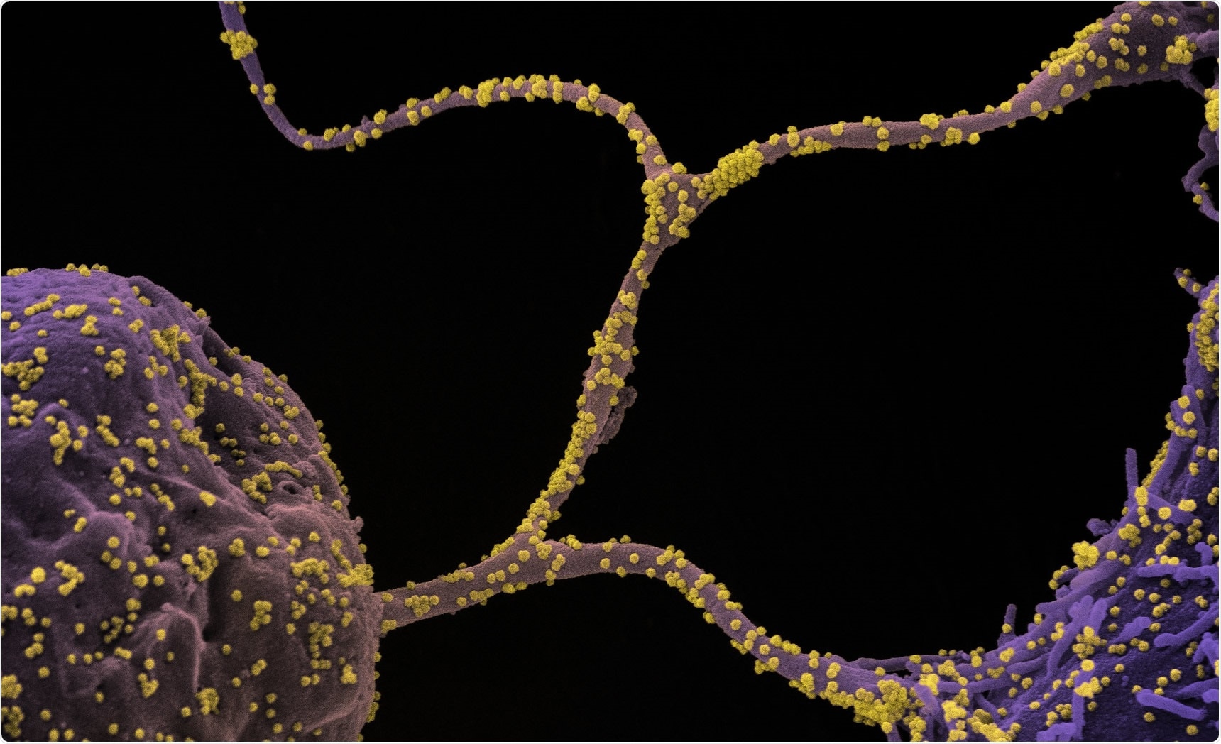 Study: Distinct Patterns of Emergence of SARS-CoV-2 Spike Variants including N501Y in Clinical Samples in Columbus Ohio. Image Credit: NIAID