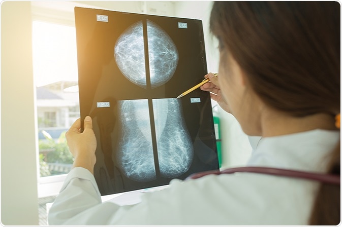mammogram
