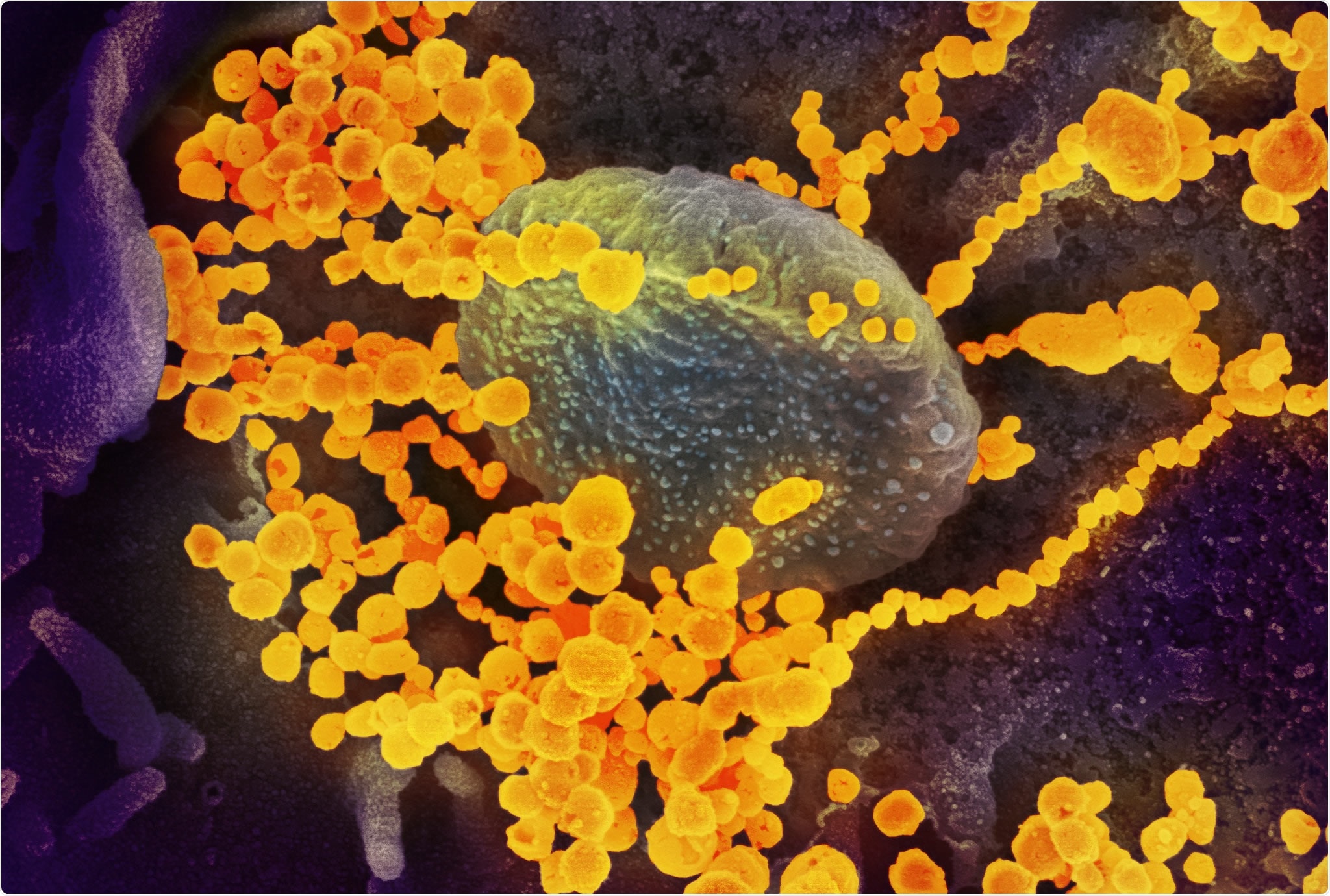 Study: REGEN-COV Antibody Combination and Outcomes in Outpatients with Covid-19. Image Credit: NIAID