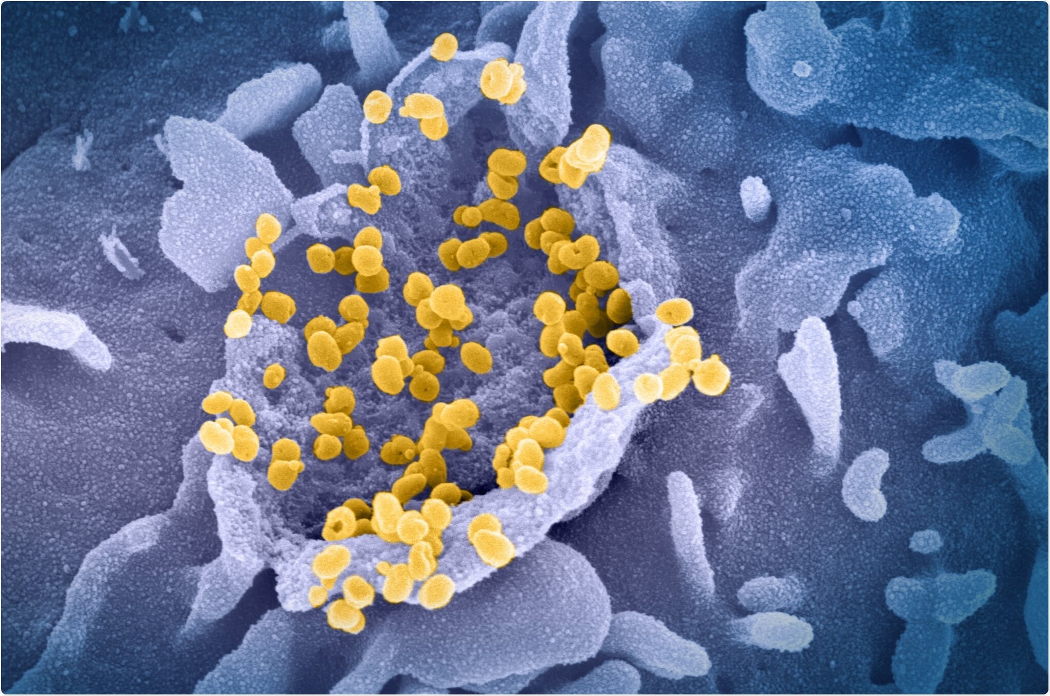 Study: Paired heavy- and light-chain signatures contribute to potent SARS-CoV-2 neutralization in public antibody responses. Image Credit: NIAID