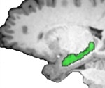 Hippocampus connects separate, distant events to form narrative memories, study shows
