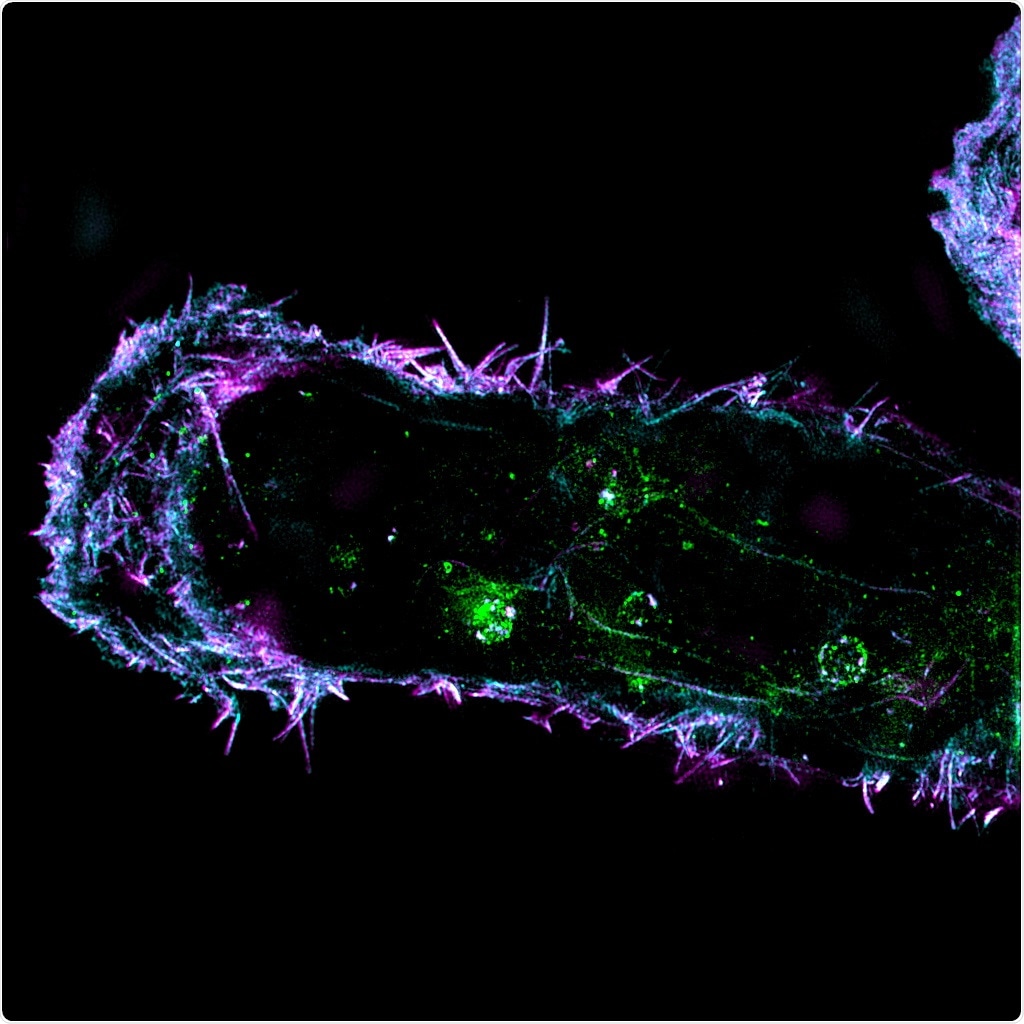 Research group uncovers novel mechanism that regulates breast cancer metastases