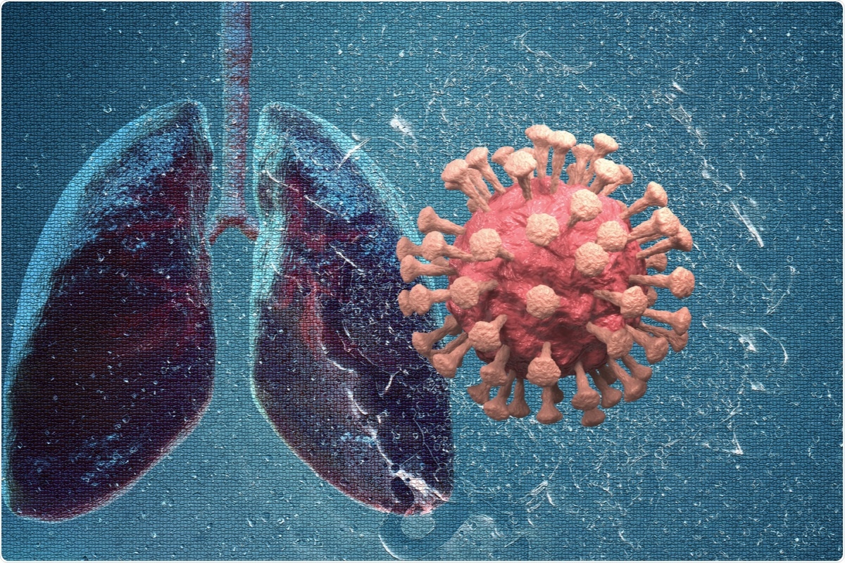 Study: Identification of COVID-19 and COPD common key genes and pathways using a protein-protein interaction approach. Image Credit: Siwakorn TH/ Shutterstock