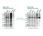 Utilizing insect cells in recombinant protein expression