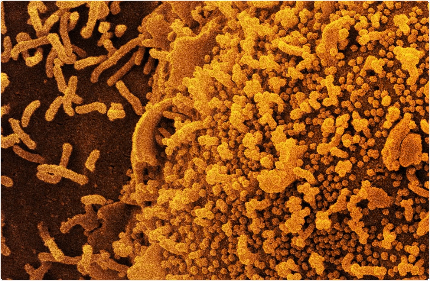 Study: SARS-CoV-2 Seroepidemiology in Children and Adolescents. Image Credit: NIAID