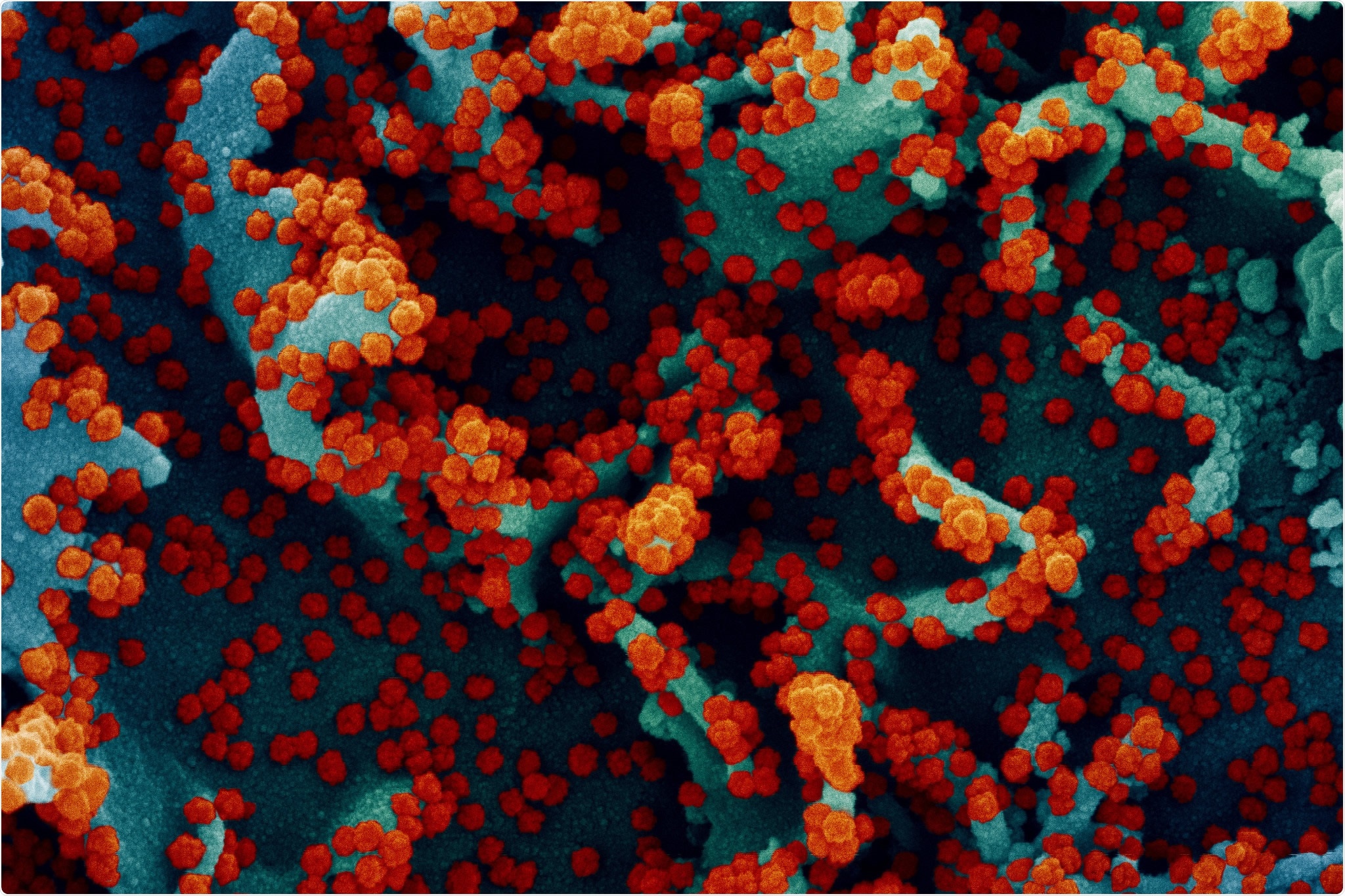 Study: Infection and mRNA-1273 vaccine antibodies neutralize SARS-CoV-2 UK variant. Image Credit: NIAID