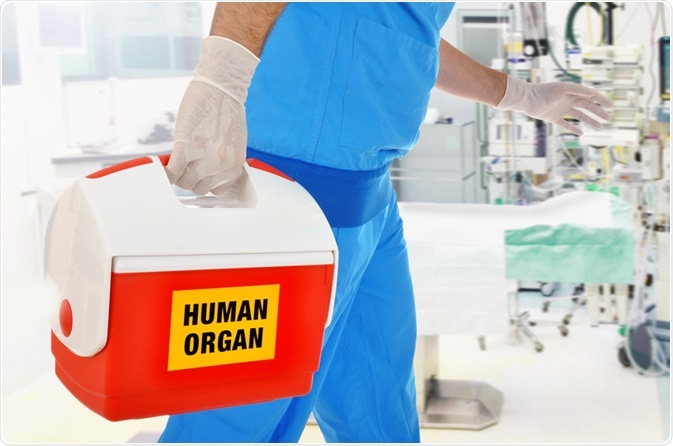 Organ Transplant