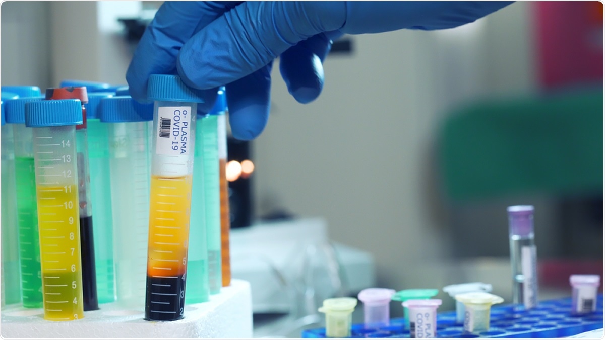 Study: CD8+ T cell responses in COVID-19 convalescent individuals target conserved epitopes from multiple prominent SARS-CoV-2 circulating variants. Image Credit: HDT Productions / Shutterstock