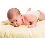 Torticollis in Babies