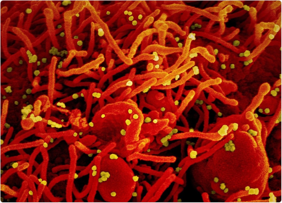 Study: Affinity biosensors developed with quantum dots in microfluidic systems. Image Credit: NIAID / Flickr