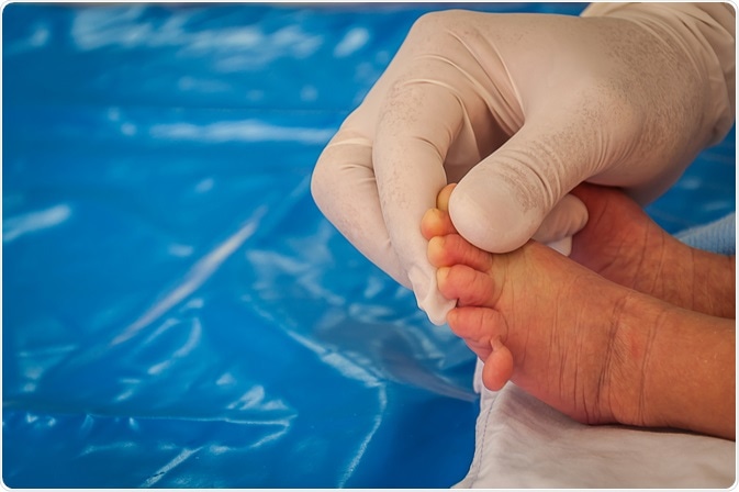 Image Credit: Arnon Thongkonghan / Shutterstock