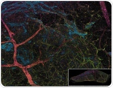Study reveals sex-differences in aging of the brain stem cell niche