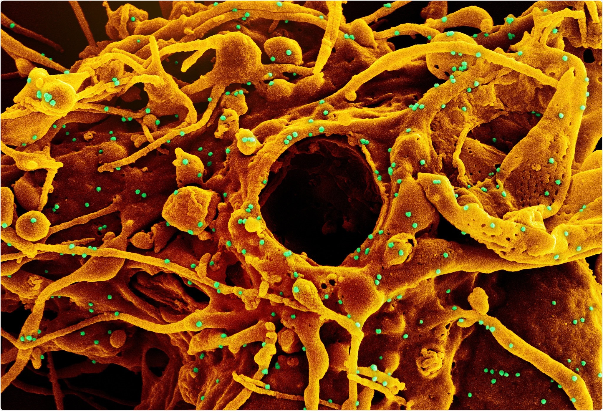 Study: Placental expression of ACE2 and TMPRSS2 in maternal SARS-CoV-2 infection: are placental defenses mediated by fetal sex?. Image Credit: NIAID