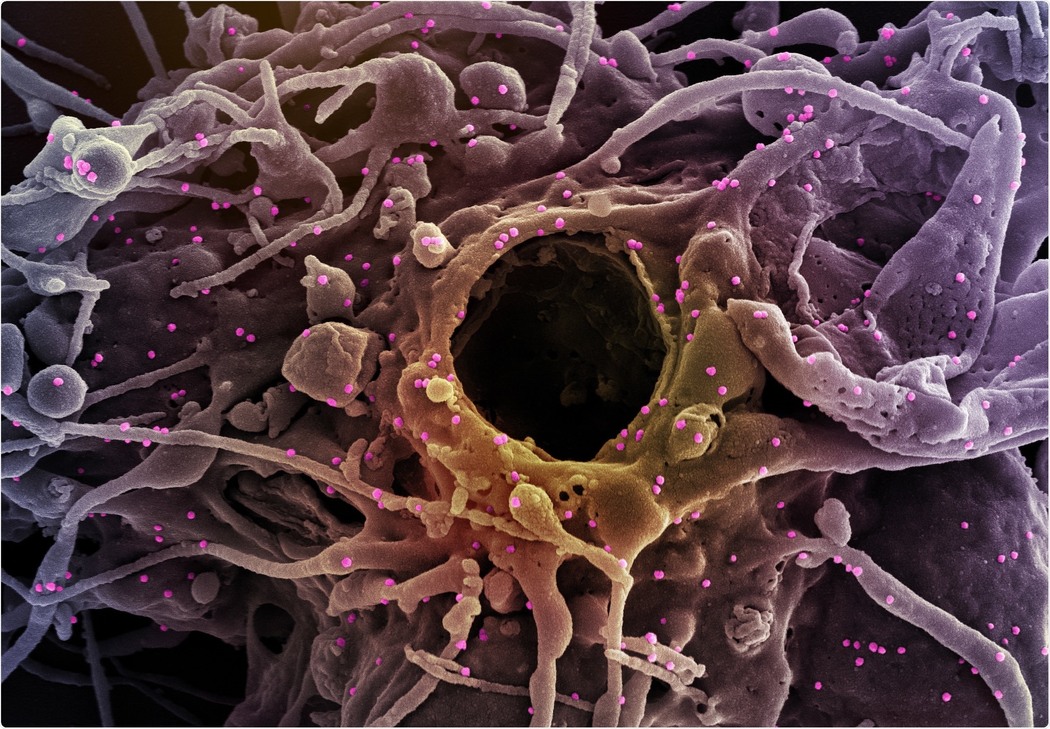 Study: The neutralization potency of anti-SARS-CoV-2 therapeutic human monoclonal antibodies is retained against novel viral variants. Image Credit: NIAID