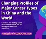 Researchers map the changing trends of cancer burden worldwide and in China