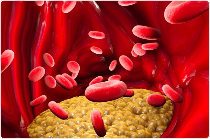 Image Credit: Naeblys / Shutterstock