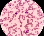 What Causes Neutropenia?