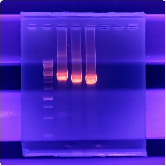 Electrophoresis