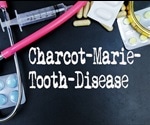 Charcot-Marie-Tooth Disease Treatment