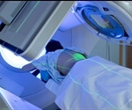 Radiation Therapy Types