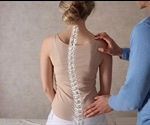 Scoliosis Cause