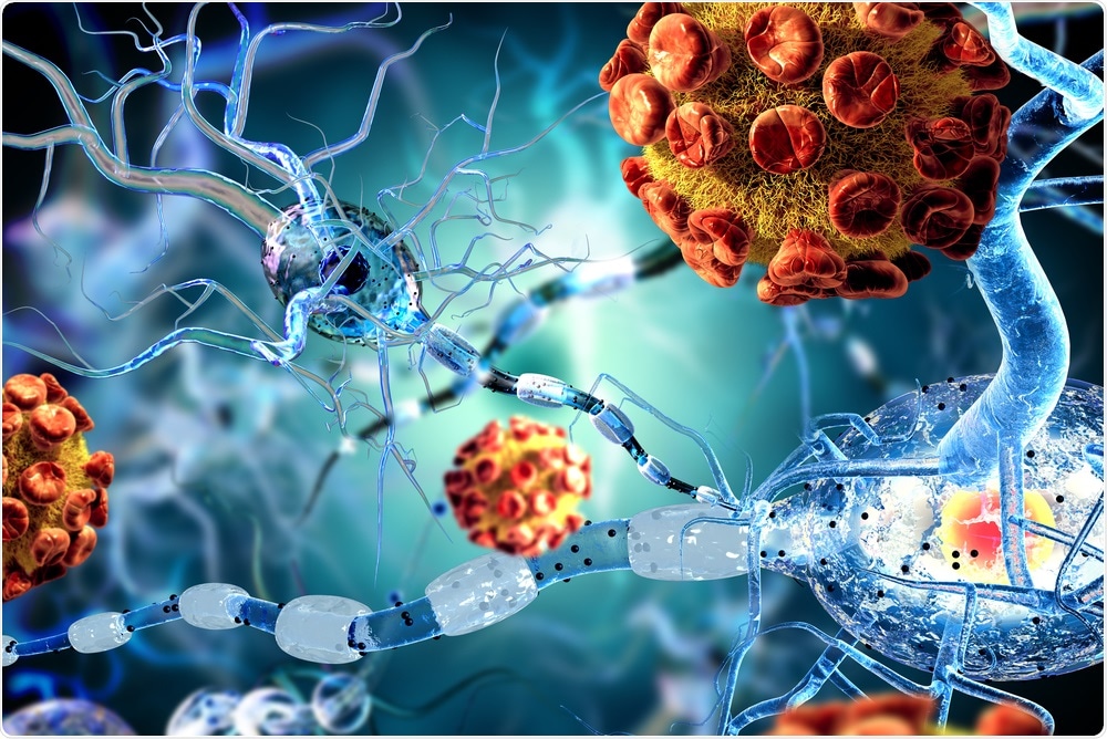 Study: Infection of brain pericytes underlying neuropathology of COVID-19 patients. Image Credit: Ralwell / Shutterstock