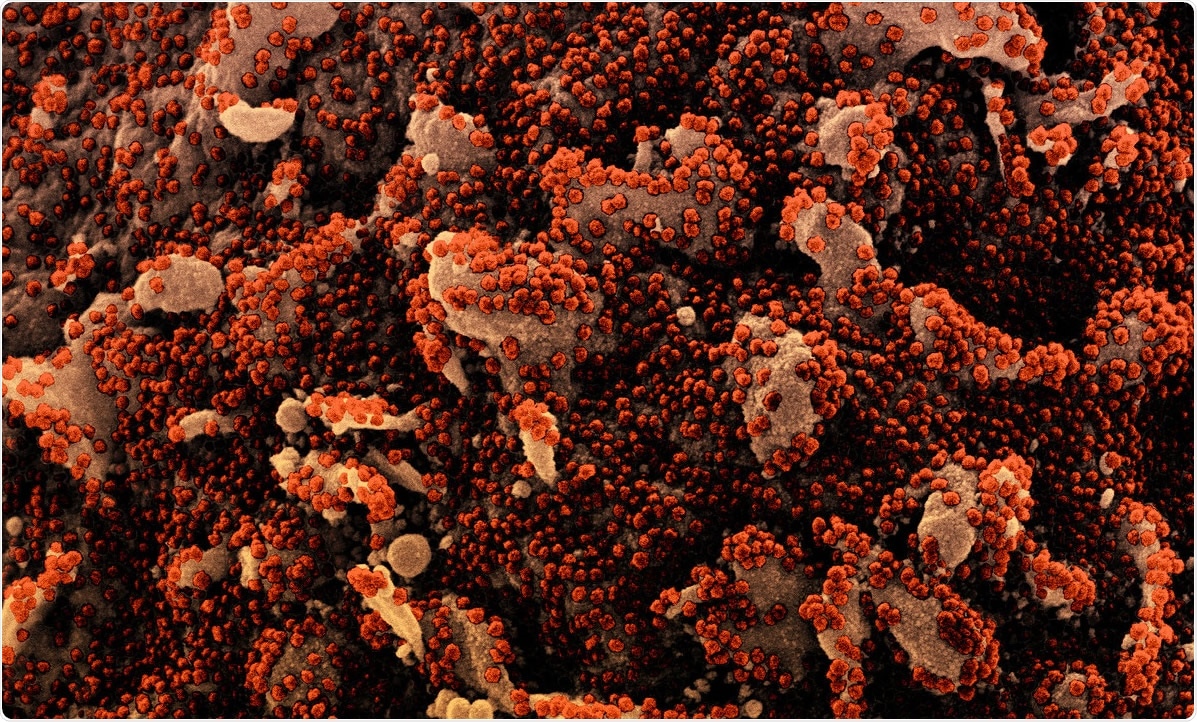 Study: Repeated Exposure to Subinfectious Doses of SARS-CoV-2 May Promote T Cell Immunity and Protection against Severe COVID-19. Image Credit: NIAID