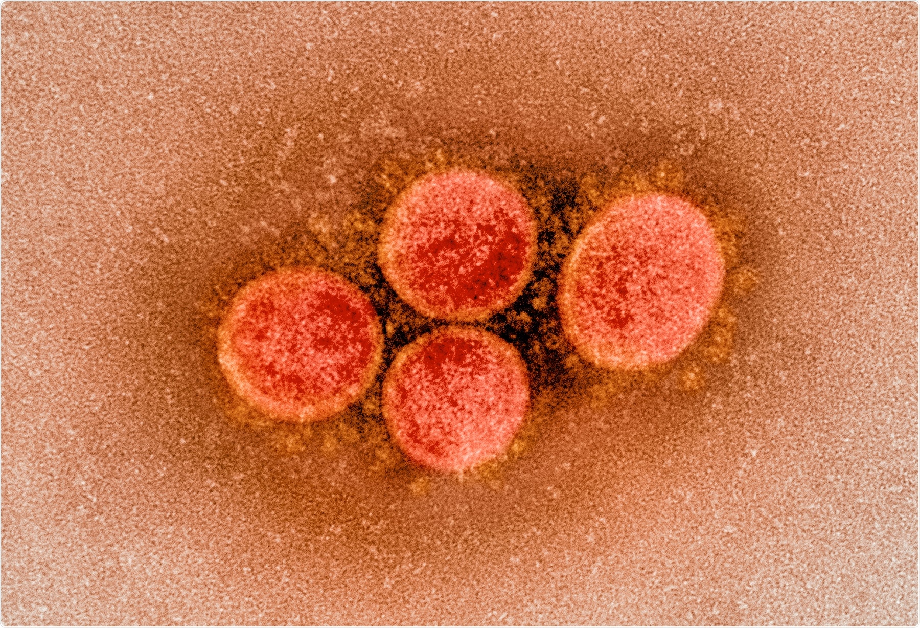 Study: Macrophages govern antiviral responses in human lung tissues protected from SARS-CoV-2 infection. Image Credit: NIAID