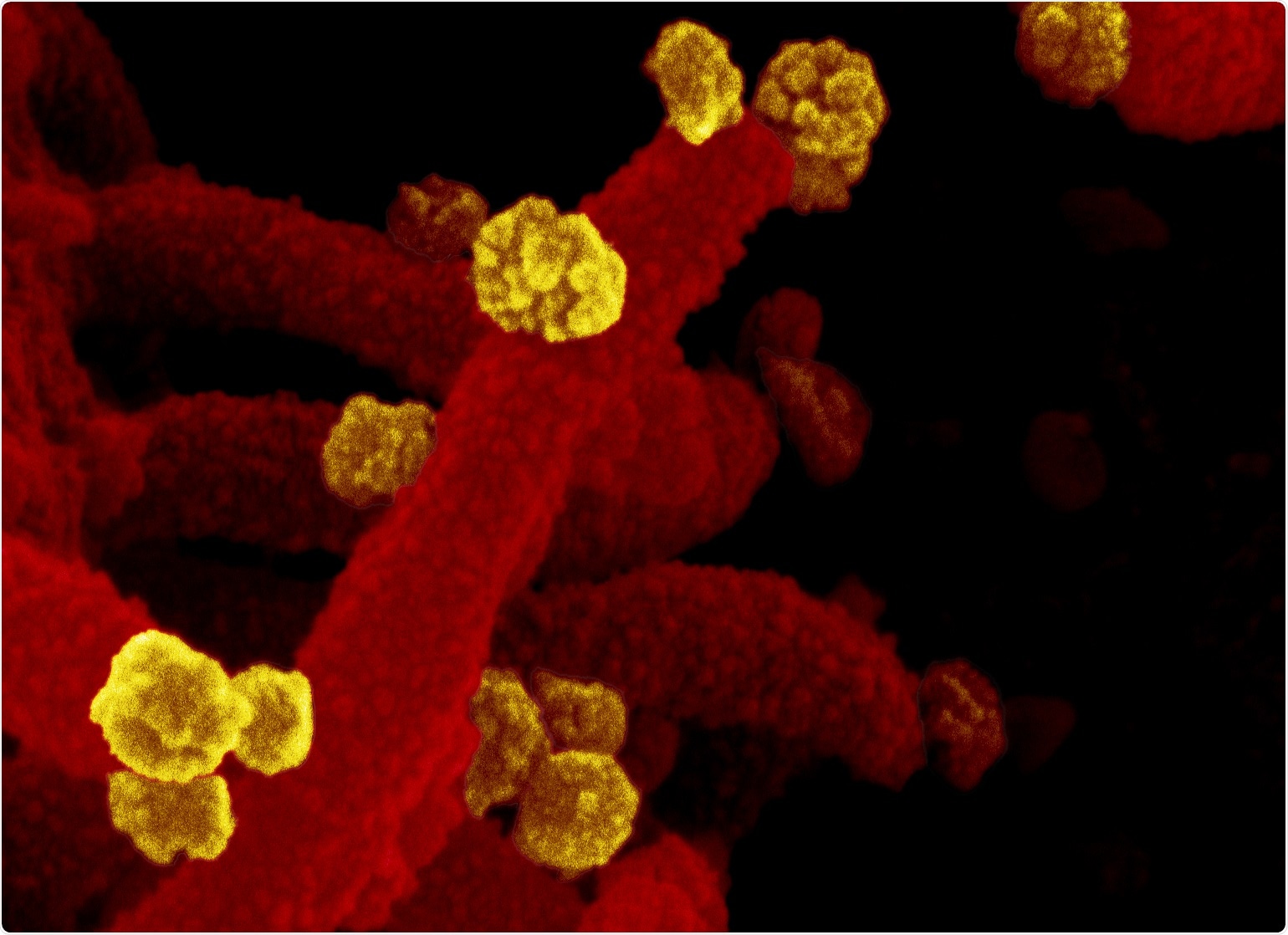 Study: Immunogenicity and pre-clinical efficacy of an OMV-based SARS-CoV-2 vaccine. Image Credit: NIAID