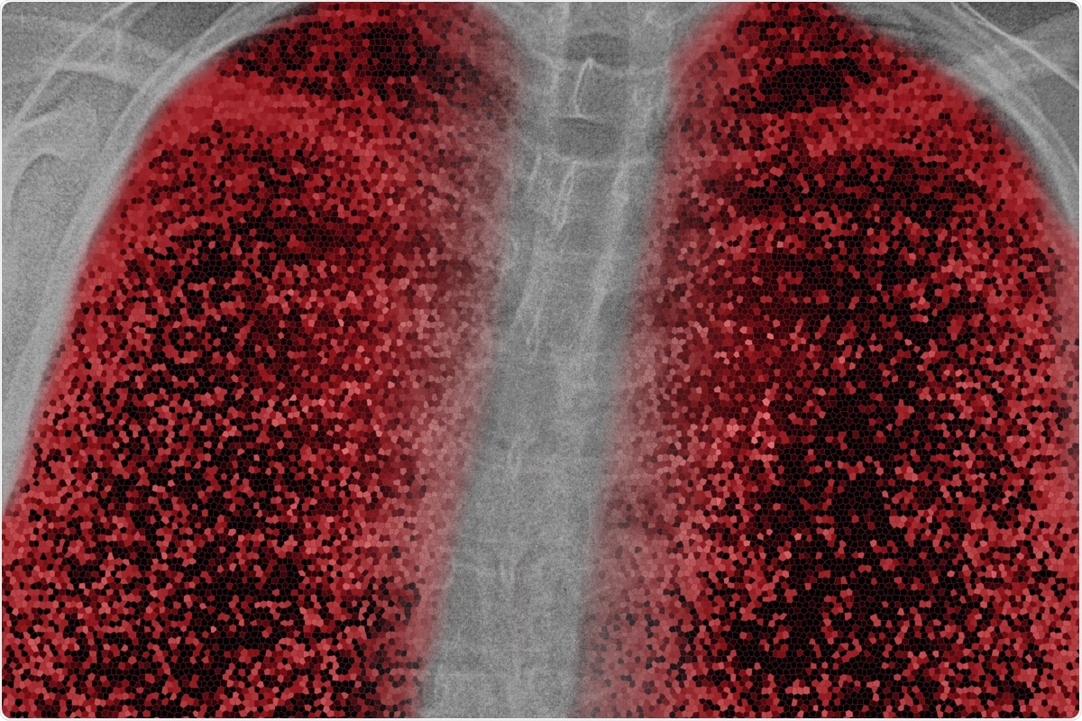 Study: Host factors facilitating SARS‐CoV‐2 virus infection and replication in the lungs. Image Credit: nnattalli / Shutterstock