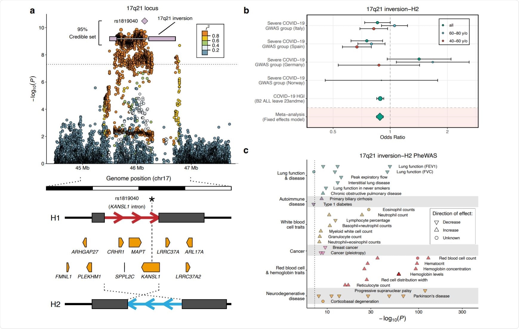 Association of the 17q21.31 locus with severe COVID-19 with respiratory failure