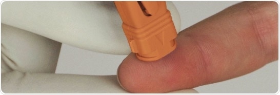 Capillary blood testing for lactate, Hb, and Hct with the StatStrip® LAC/Hb/Hct