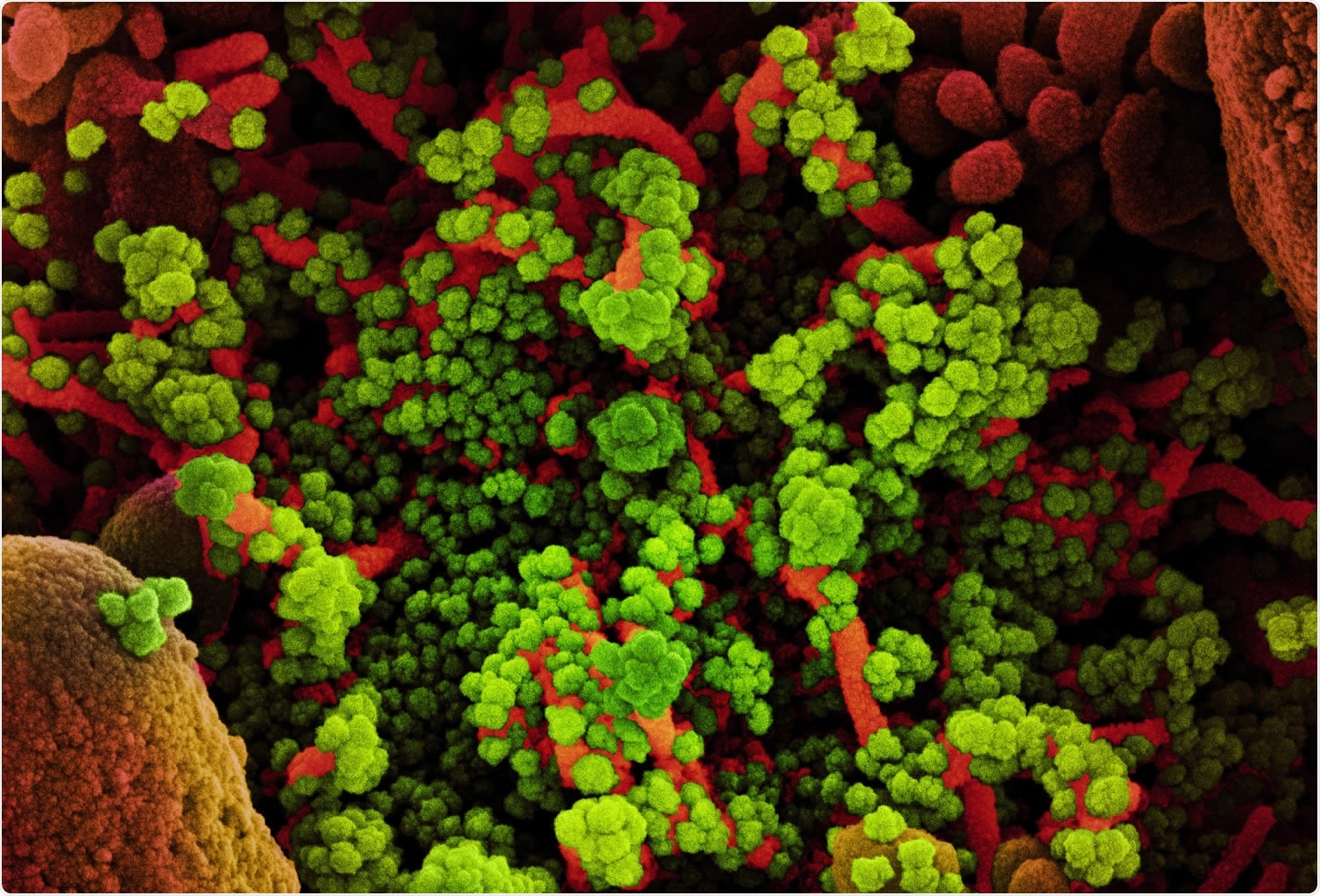 Study: B and T cell responses after a third dose of SARS-CoV-2 vaccine in Kidney Transplant Recipients. Image Credit: NIAID