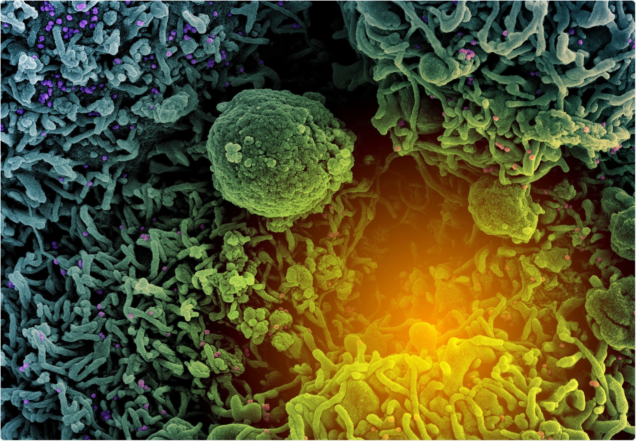 Study: Population birth outcomes in 2020 and experiences of expectant mothers during the COVID-19 pandemic: a ‘Born in Wales’ mixed methods study using routine data. Image Credit: NIAID