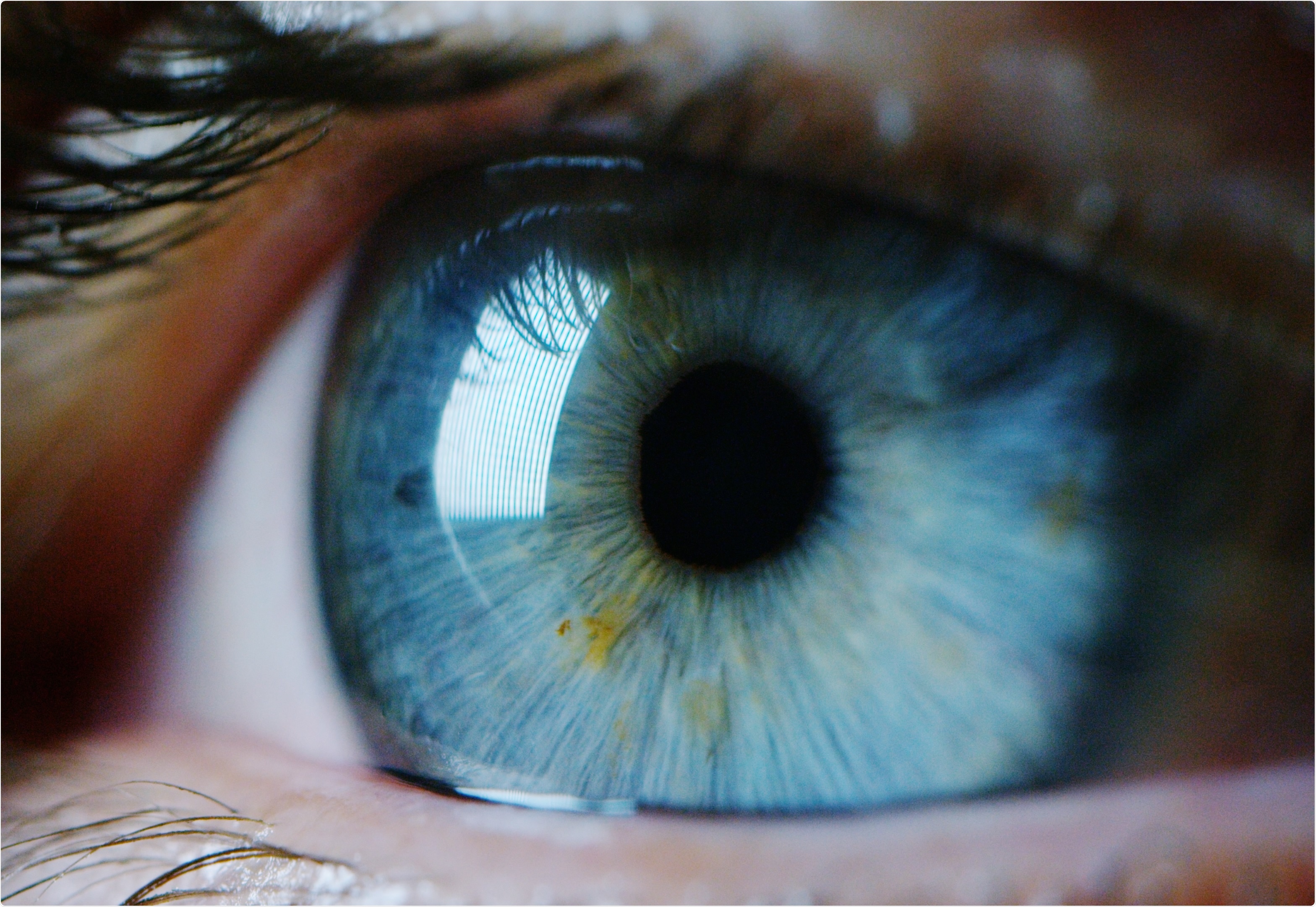 Study: Tear antibodies to SARS-CoV-2: implications for transmission. Image Credit: HQuality / Shutterstock