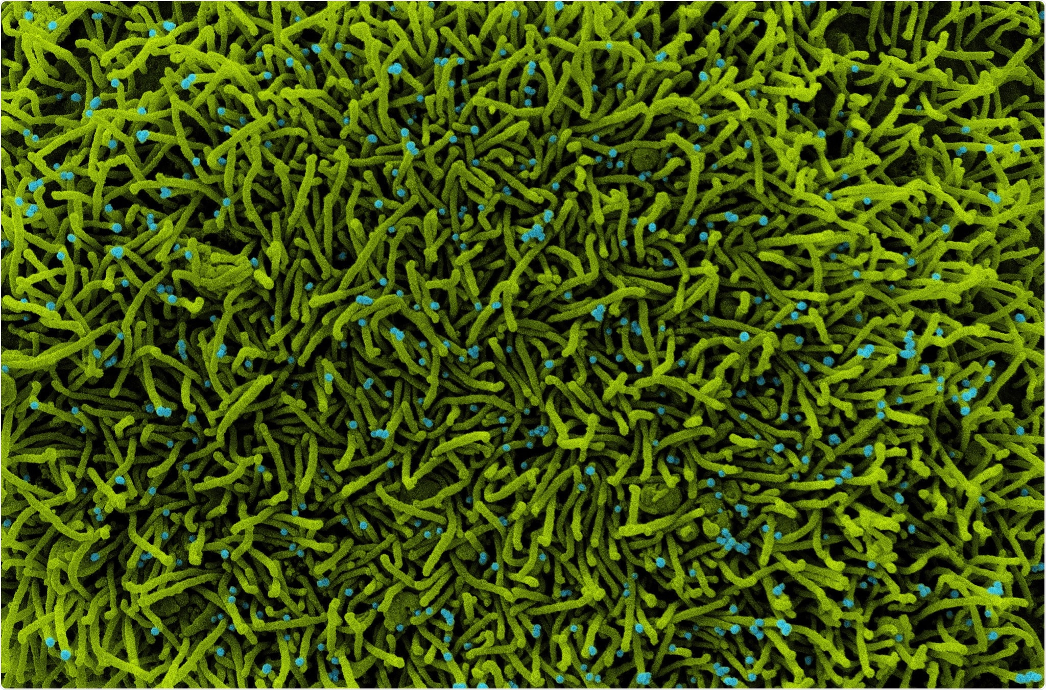 Study: Deep immune profiling reveals early-stage and highly coordinated immune responses in mild COVID-19 patients. Image Credit: NIAID