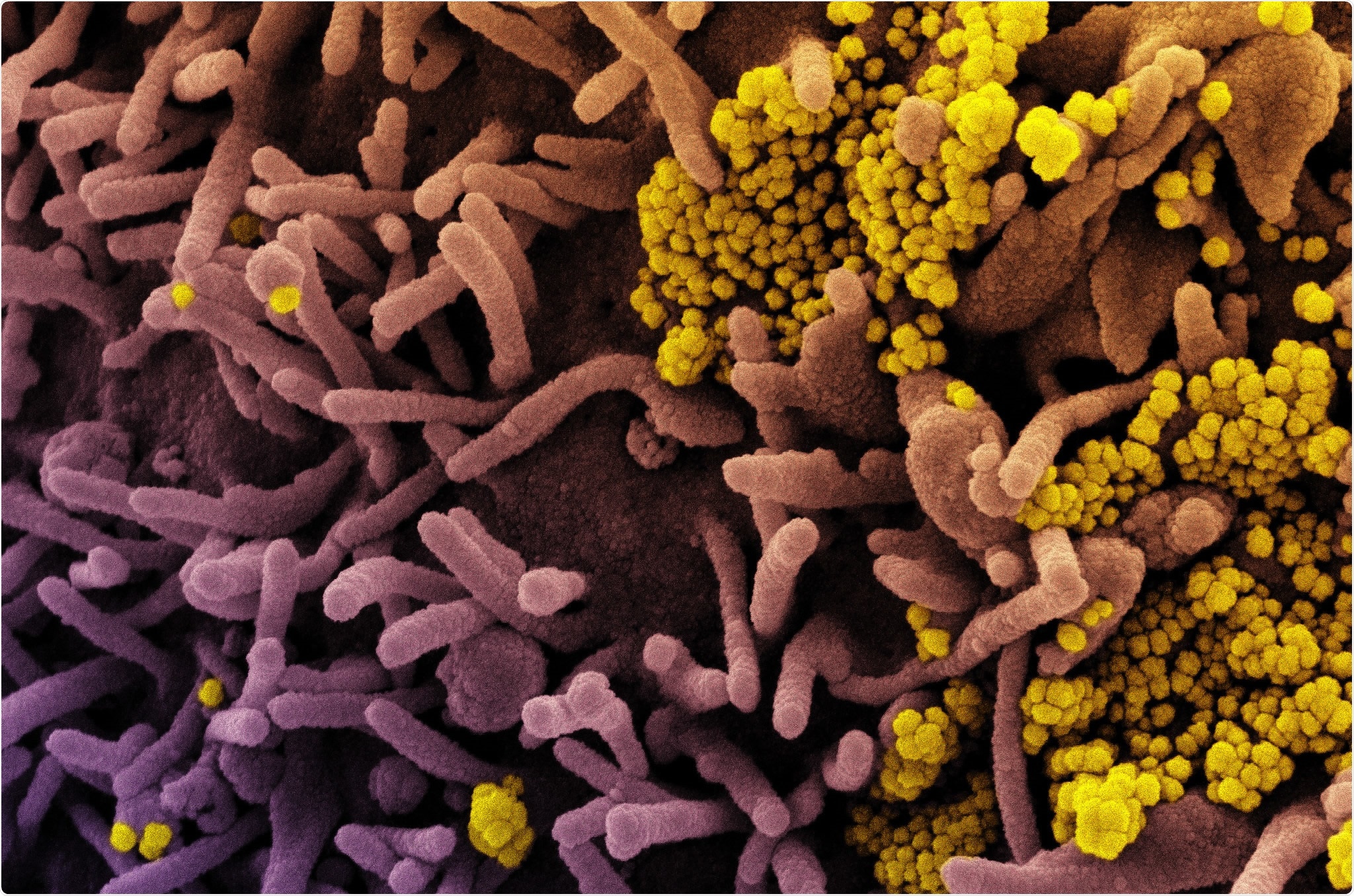 Study: LRRC15 mediates an accessory interaction with the SARS-CoV-2 spike protein. Image Credit: NIAID