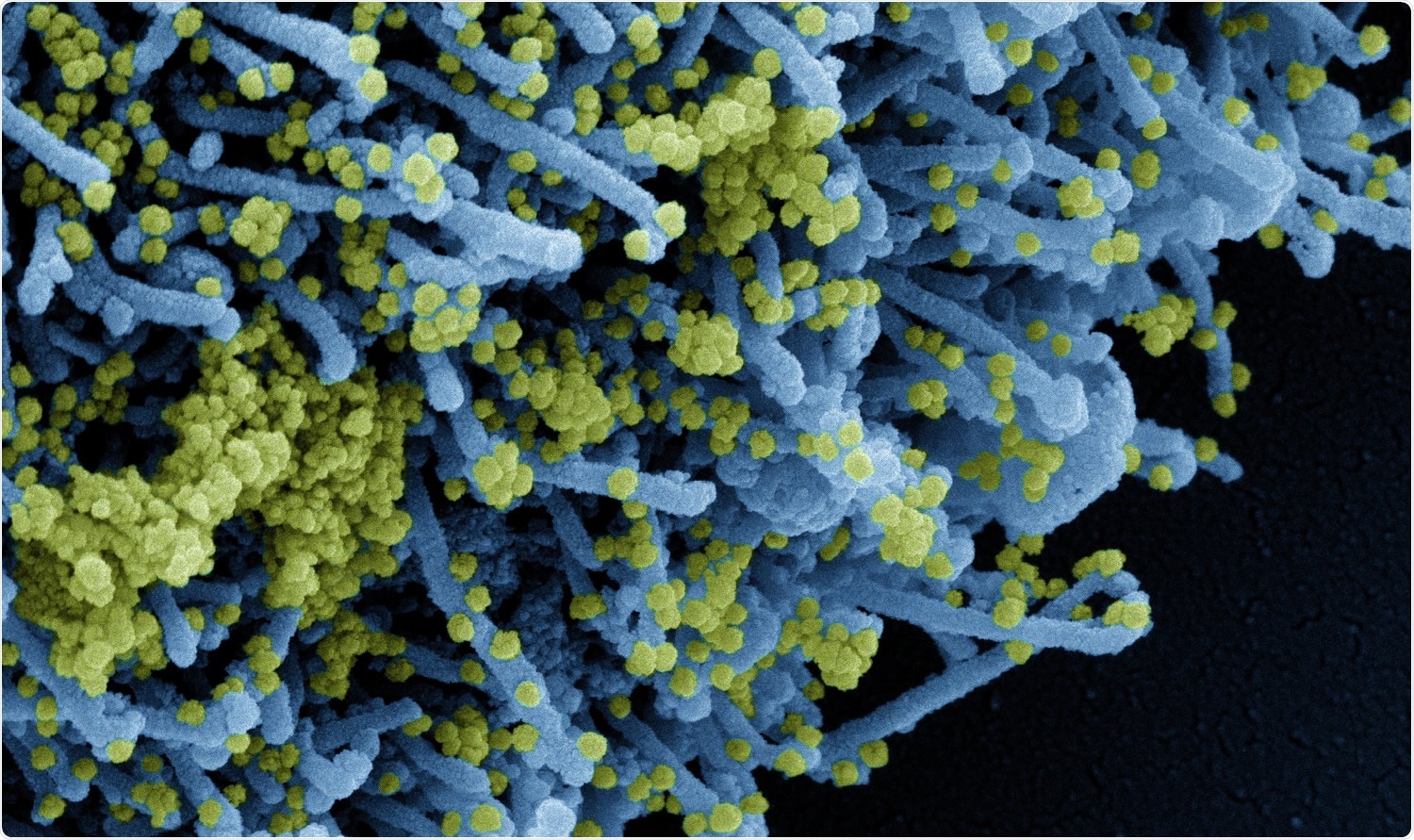 Study: The Delta Variant Had Negligible Impact on COVID-19 Vaccine Effectiveness in the USA. Image Credit: NIAID