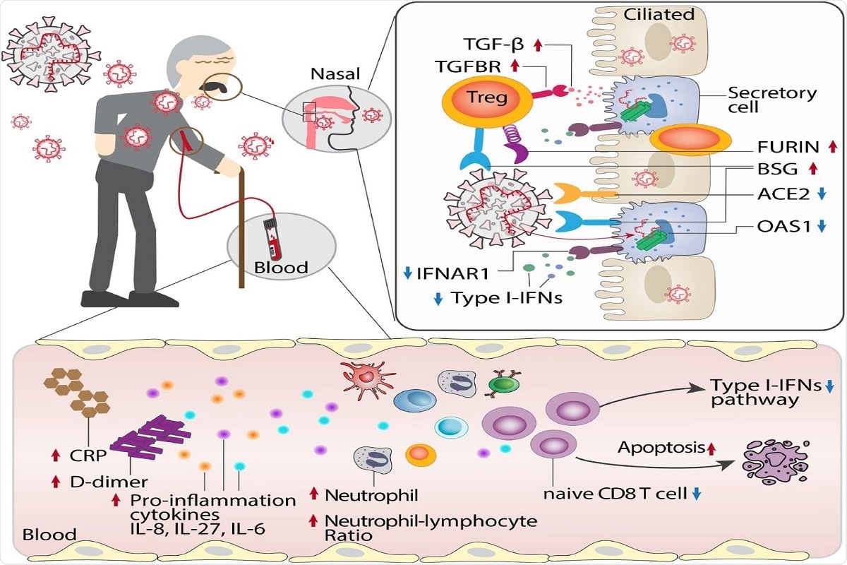 Figure 6. Proposed mechanistic models for age-biased COVID-19 severity in aged individuals. Several age-related pathophysiologic immune responses are associated with disease susceptibility and severity in COVID-19: a) decreased lymphocyte count and elevated inflammatory markers (C-reactive protein [CRP], D-dimer, and neutrophil-lymphocyte ratio); b) elevated pro-inflammation cytokines IL-8, IL-27 and IL-6 in aged COVID19 patients; c) reduced abundance of naïve CD8 T cells with decreased expression of antiviral defense genes (i.e., IFITM3 and TRIM22) in aged individuals with severe COVID-19; d) type I interferon deficiency is associated with SARS-CoV-2 viral load in aged individuals; e) elevated expression of SARS-CoV-2 entry factors (BSG and FURIN) and reduced expression of antiviral defense genes (IFNAR1, OAS1, IFIT1) in the secretory cells of critical COVID-19 in aged individuals; f) strong TGF-beta mediated immune-epithelial cell interactions (i.e., secretory – T regulatory cells) in aged individuals with critical COVID-19.