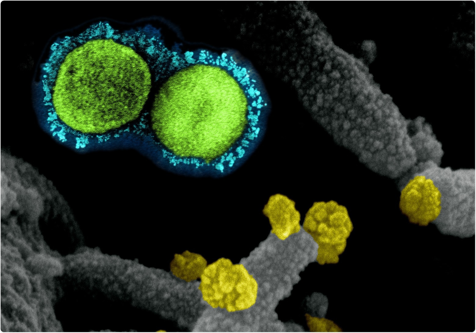 Study: Neutralizing efficacy of vaccines against the SARS-CoV-2 Mu variant. Image Credit: NIAID